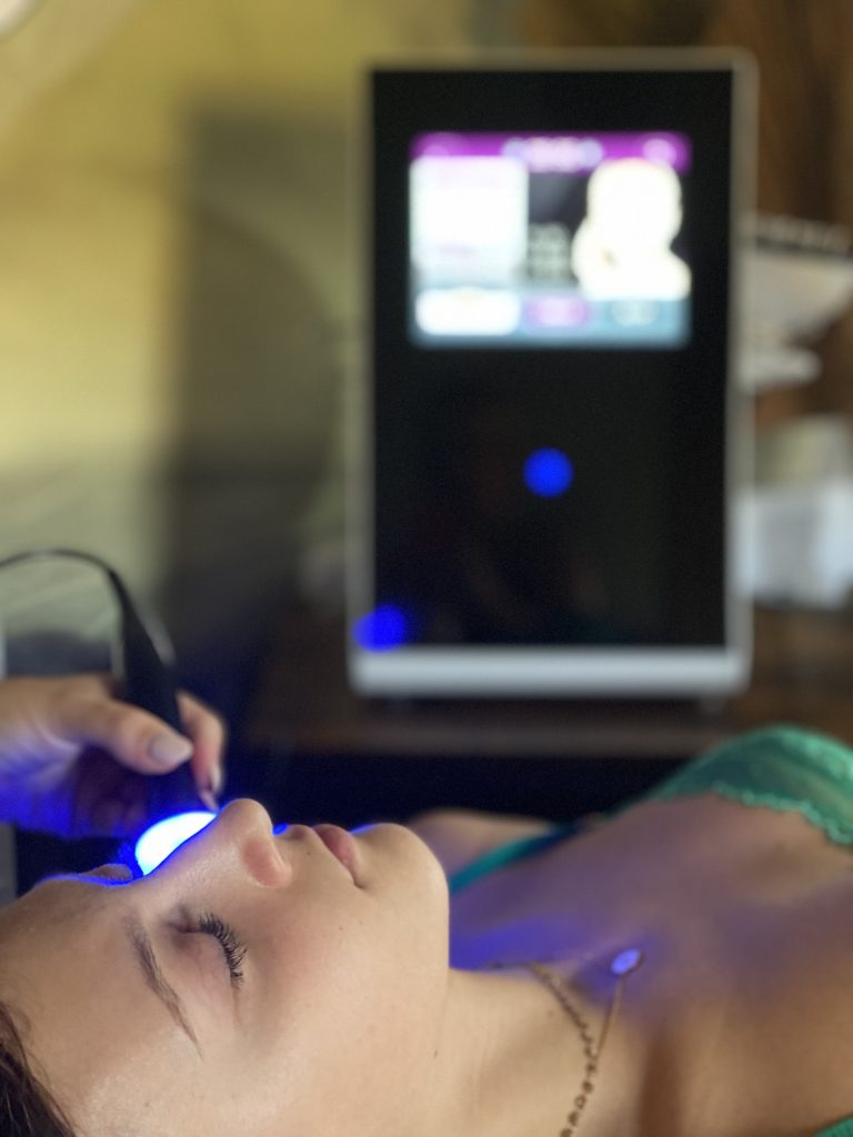 radiofréquence RF sylphidecolor