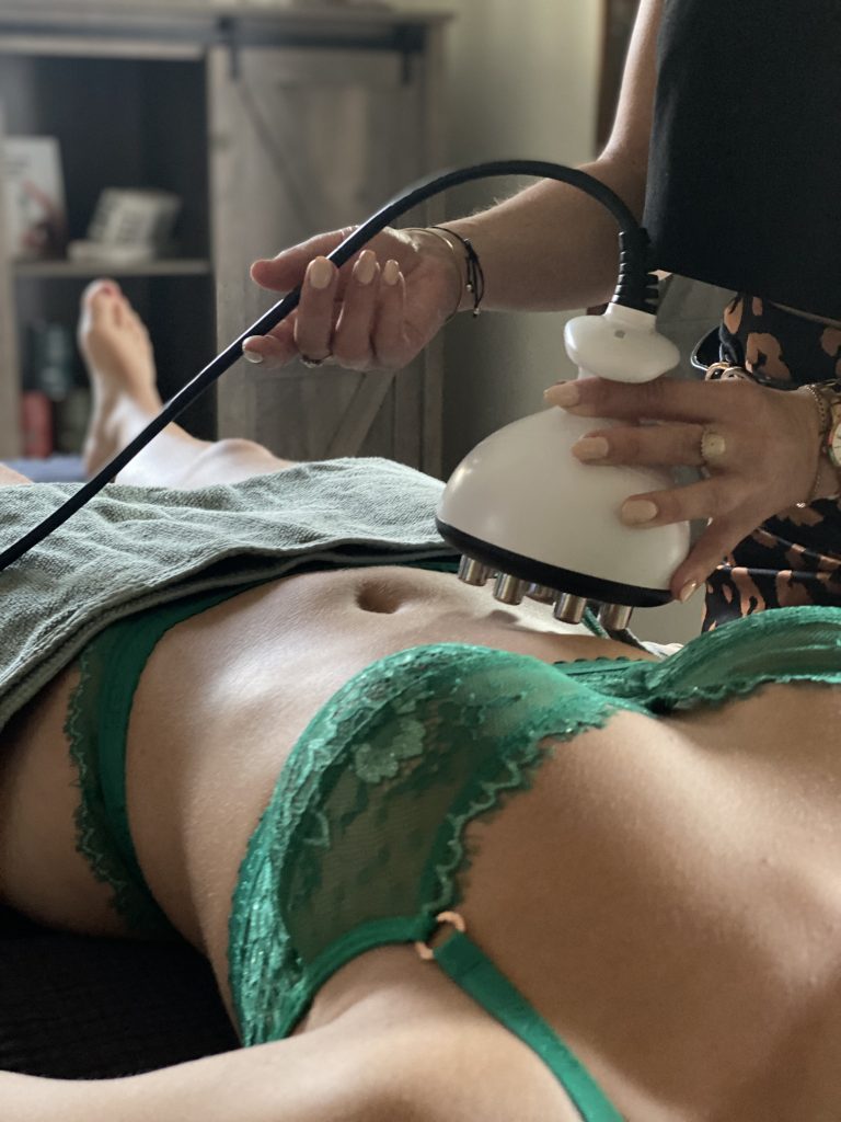 radiofréquence RF sylphidecolor